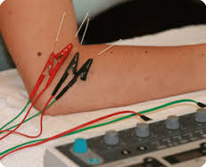 Elektro-Acupunctuur Elleboog 